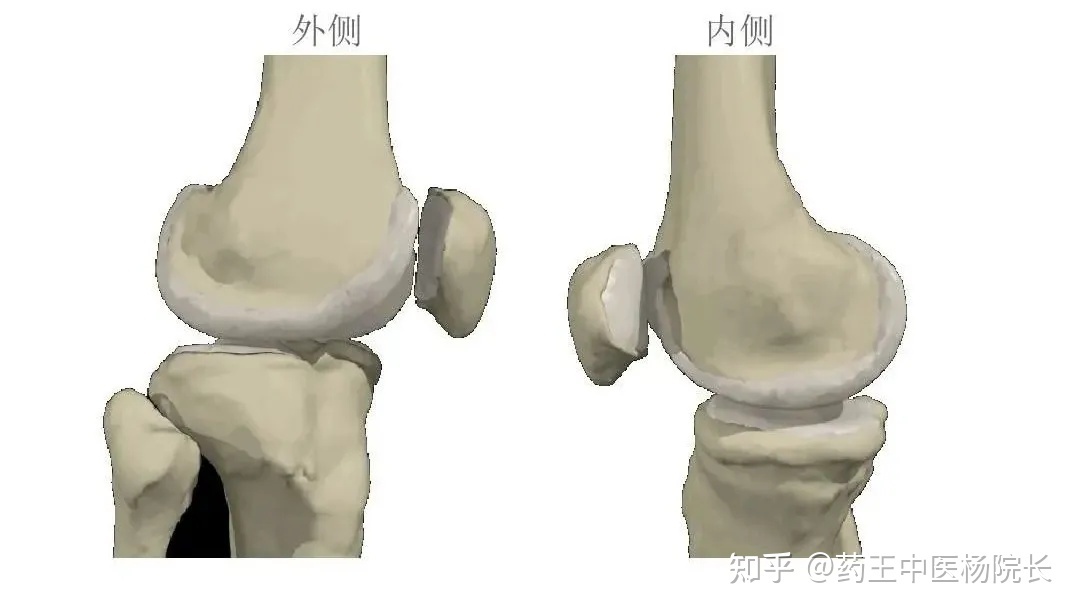 踢足球髌骨_踢足球髌骨软骨损伤