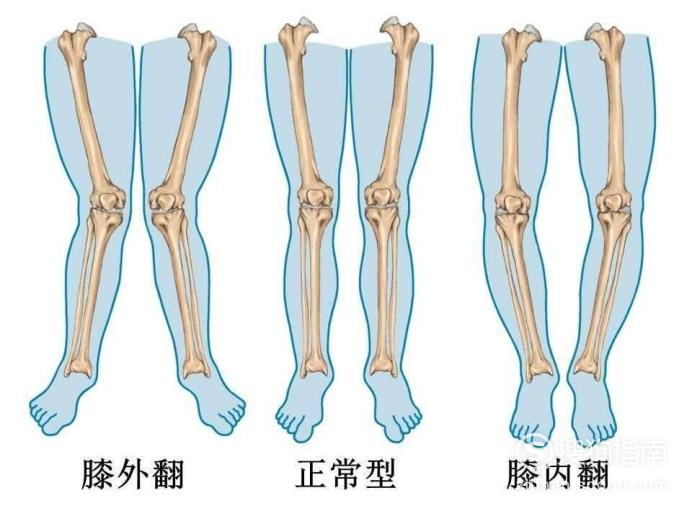 o型腿足球_o型腿足球运动员