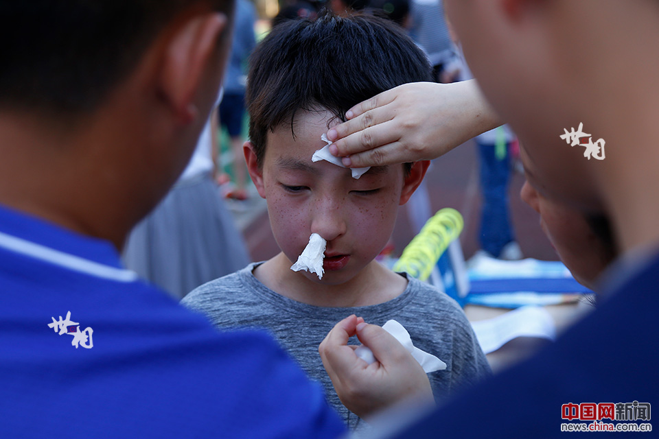 脸被足球砸到如何快速消肿_脸部被足球踢中后疼痛怎么办