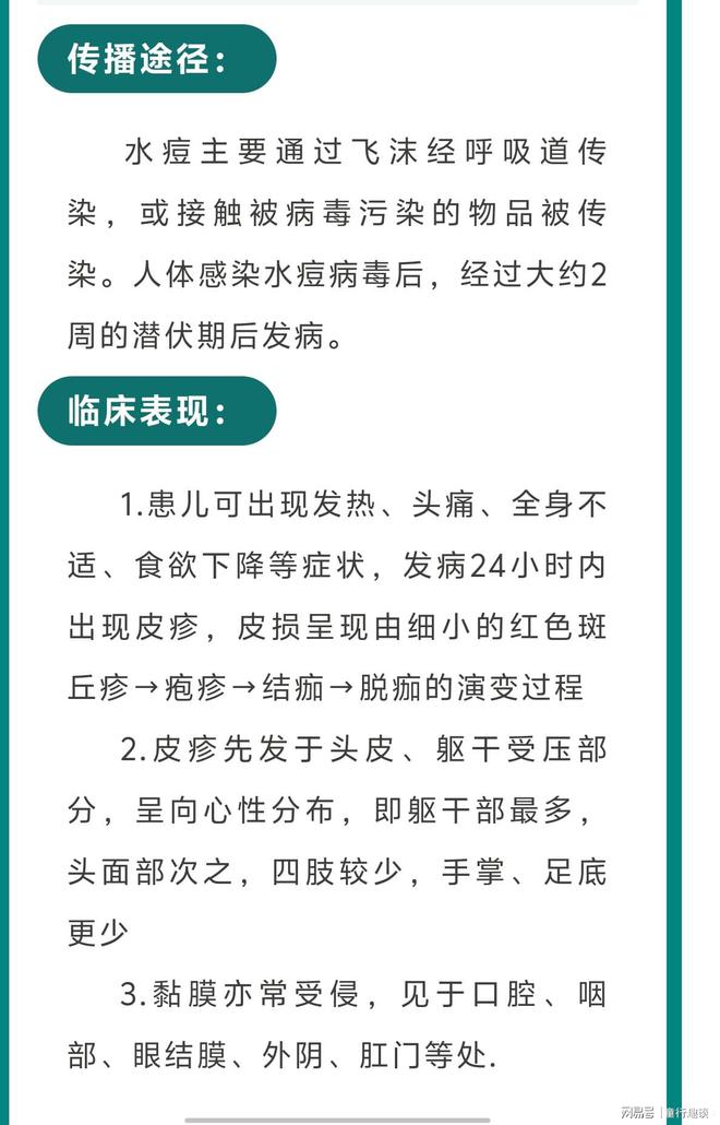 幼儿园常识教案:预防水痘_春季水痘预防常识